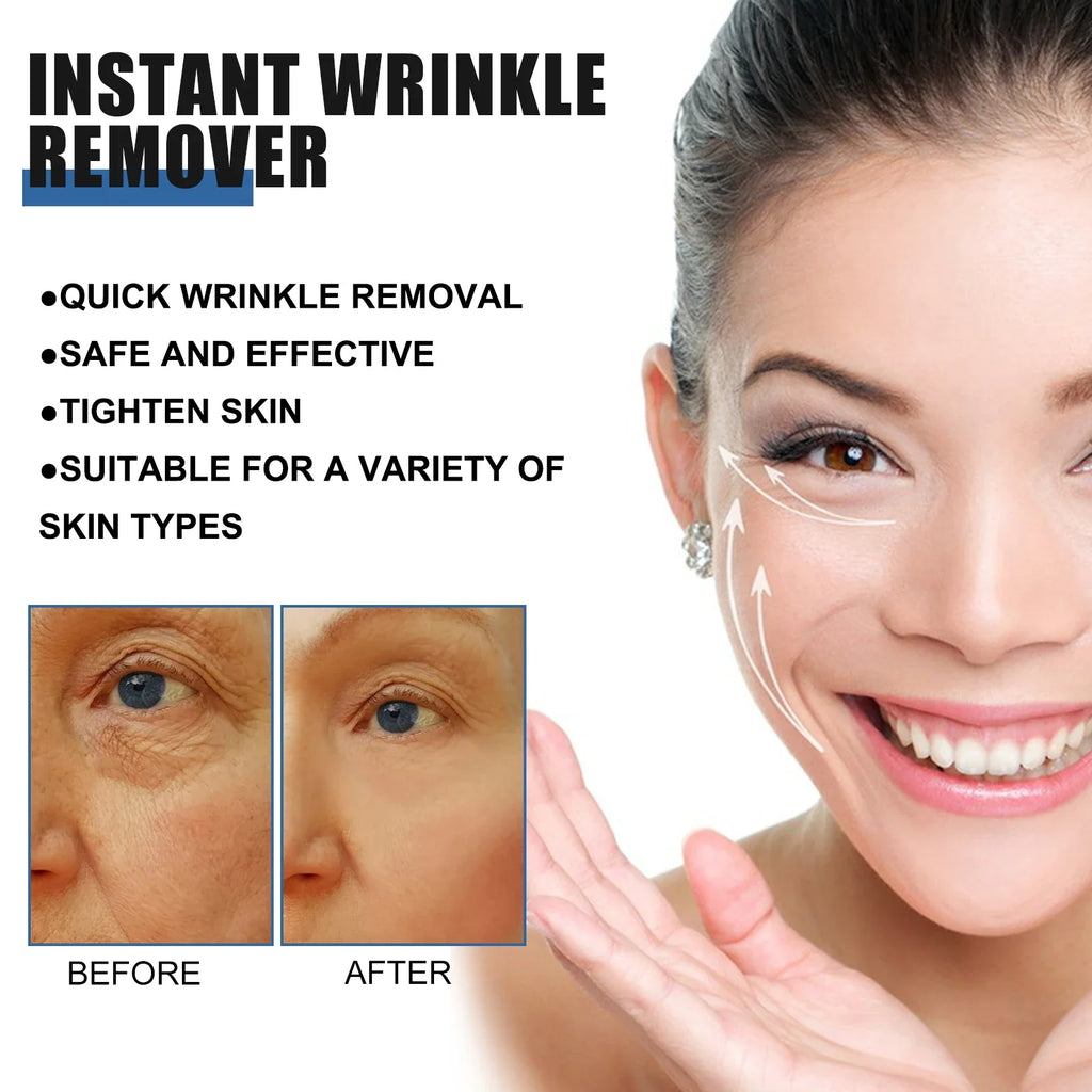 Retinol Anti-Wrinkle Face Cream – Deep Hydrating & Firming 30ml