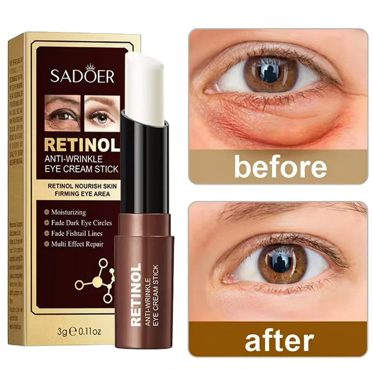 Retinol Eye Cream – Dark Circles, Fine Lines & Wrinkles