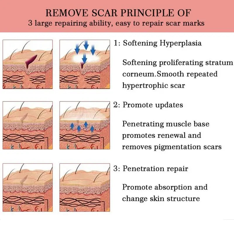 Lavender Scar Repair Cream – Fade Acne Marks & Smooth Skin