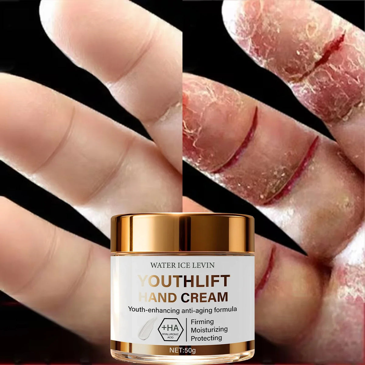 YouthLift Anti-Aging Hand Cream – HA & Retinol, 50g