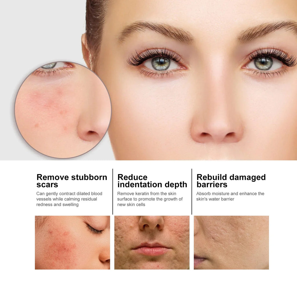Eelhoe Nourishing Face Serum – Pore Minimizing & Brightening