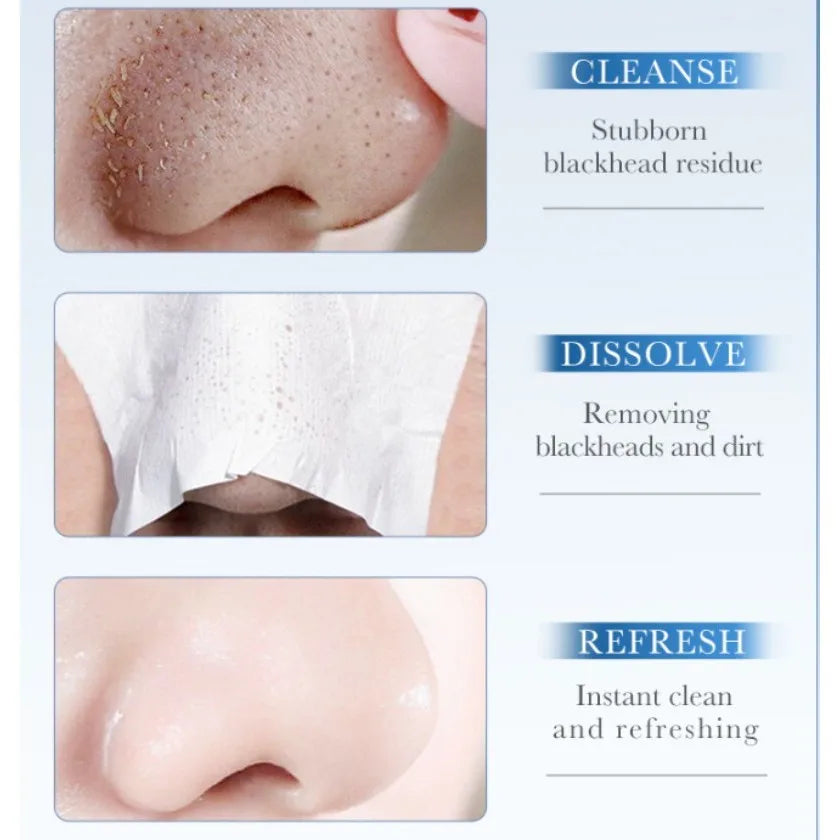 SADOER Blackhead Remover Nose Mask – Deep Pore Cleansing