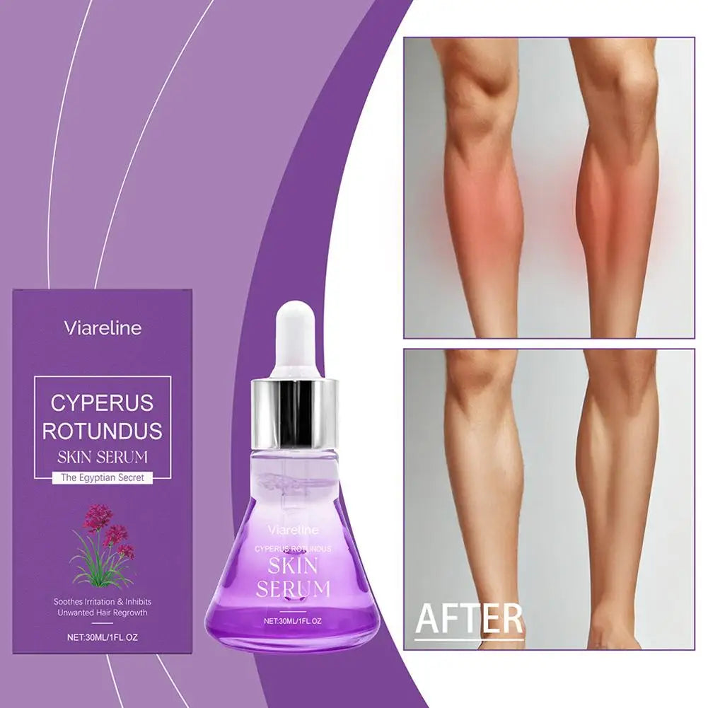 Post Hair Removal Serum – Hyaluronic Acid & Ceramide 30ml