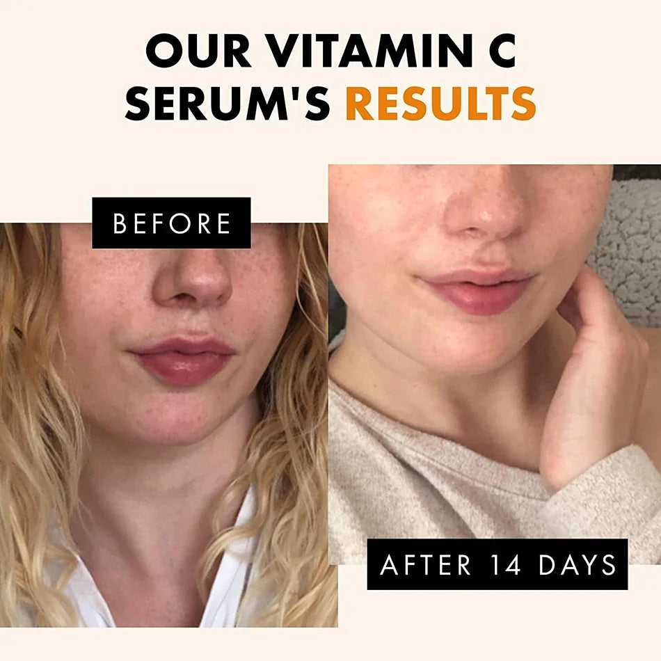 99 Vitamin C Serum Oil Facial AHA Kojic Acid Glutathione Skin