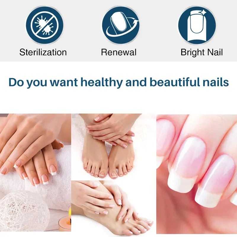 YUITIKUE Ginger King Nail Care Cream – 7-Day Results | 60g