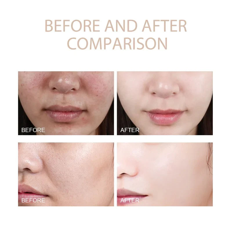 Exfoliating Gel Scrub – Deep Clean Face & Body, Unclog Pores