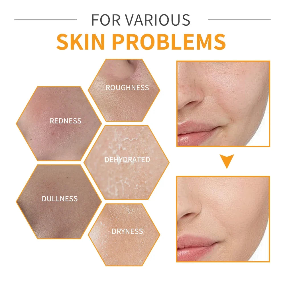 Vitamin C 6-Piece Skin Care Set – Brighten & Moisturize