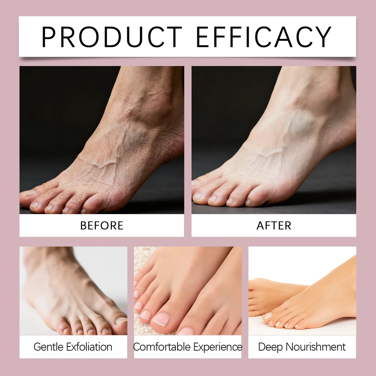 OceAura Shea Butter Hydrating Foot Mask Booties – 6 Pairs