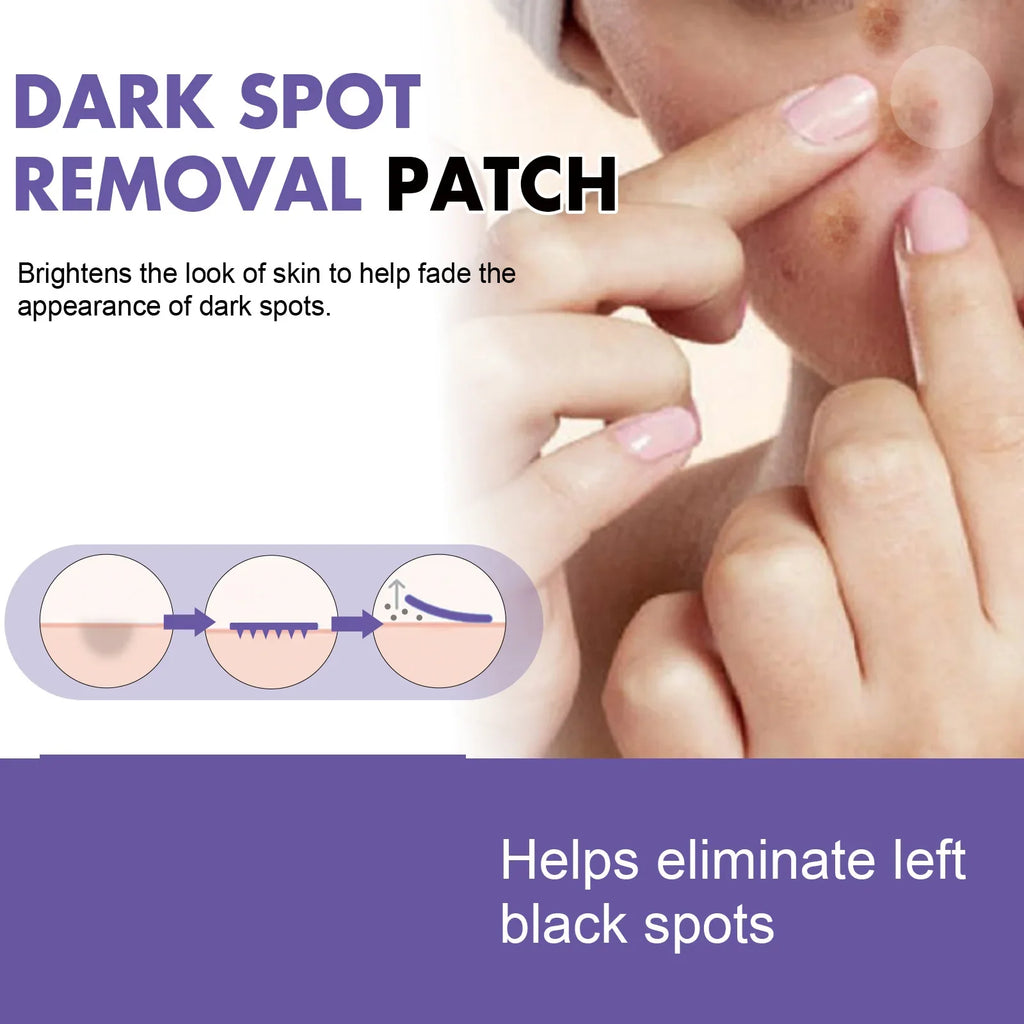 Eelhoe Dark Spot Correcting Patches – Brighten & Fade Spots