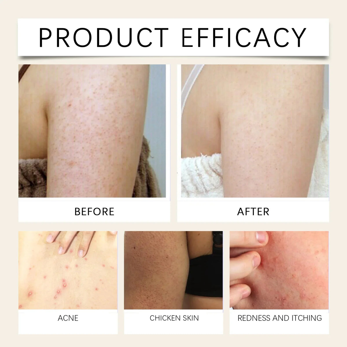 Ximonth Botanical Hydrating Face Mist – Calming Skin Spray