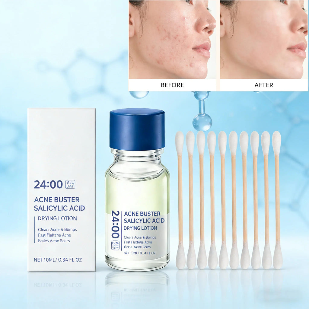 Hoygi Salicylic Acid Acne Serum – Pores, Blackheads & Oil