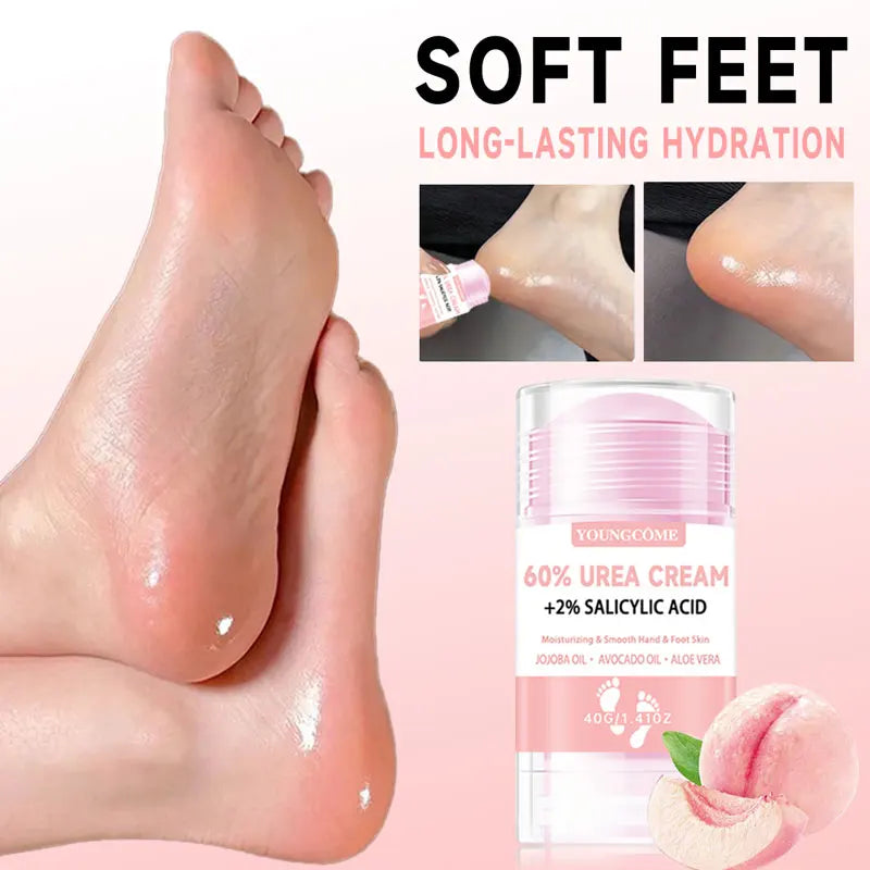 YOUNGCOME 60% Urea Foot Cream + Salicylic Acid | 40g