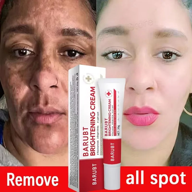 Brightening Dark Spot Corrector Cream – Niacinamide & Vitamin C