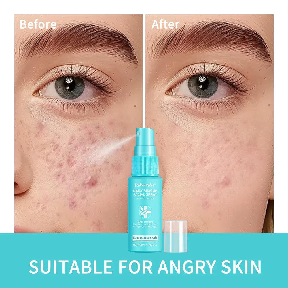 Hypochlorous Acid Facial Toner Spray – pH Balance, 30ml