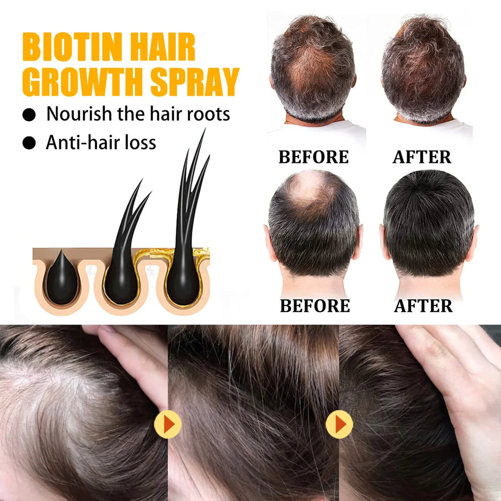 Biotin Hair Care Spray Nourish Scalp Follicle Reduce Loss Stabiliz