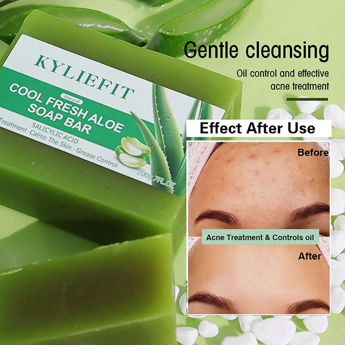 AILKE Aloe Brightening Soap Bar | Dark Spot & Oil Control 200g