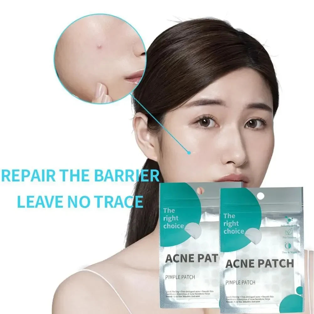 Hydrocolloid Star Acne Patches – Pimple Repair & Invisible Cover