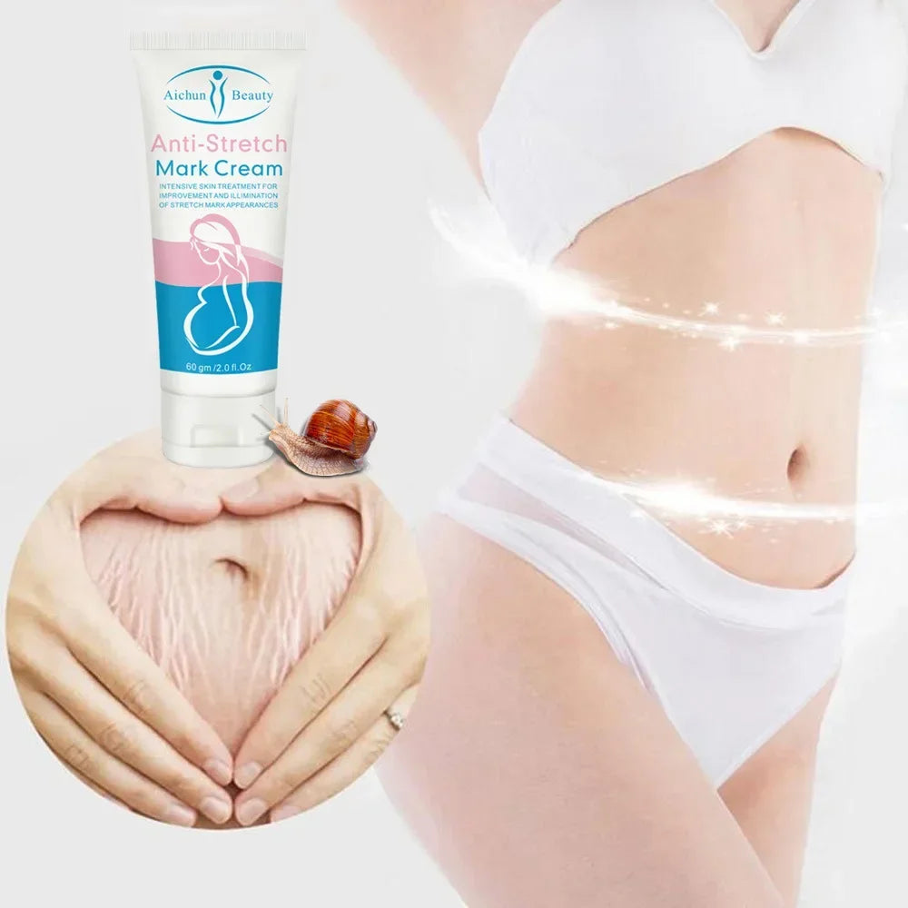 Snail Removes Stretch Mark Cream Remove Postpartum Obesity Pregnant