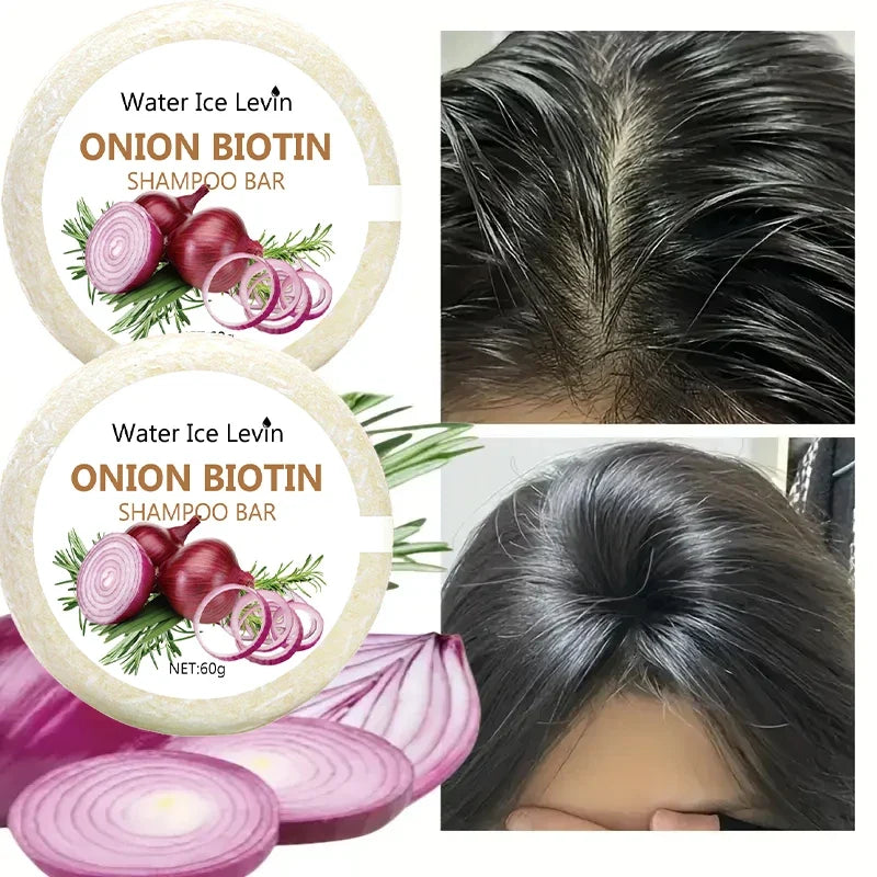 Onion & Biotin Shampoo Bar 60g | Rosemary, All Hair Types