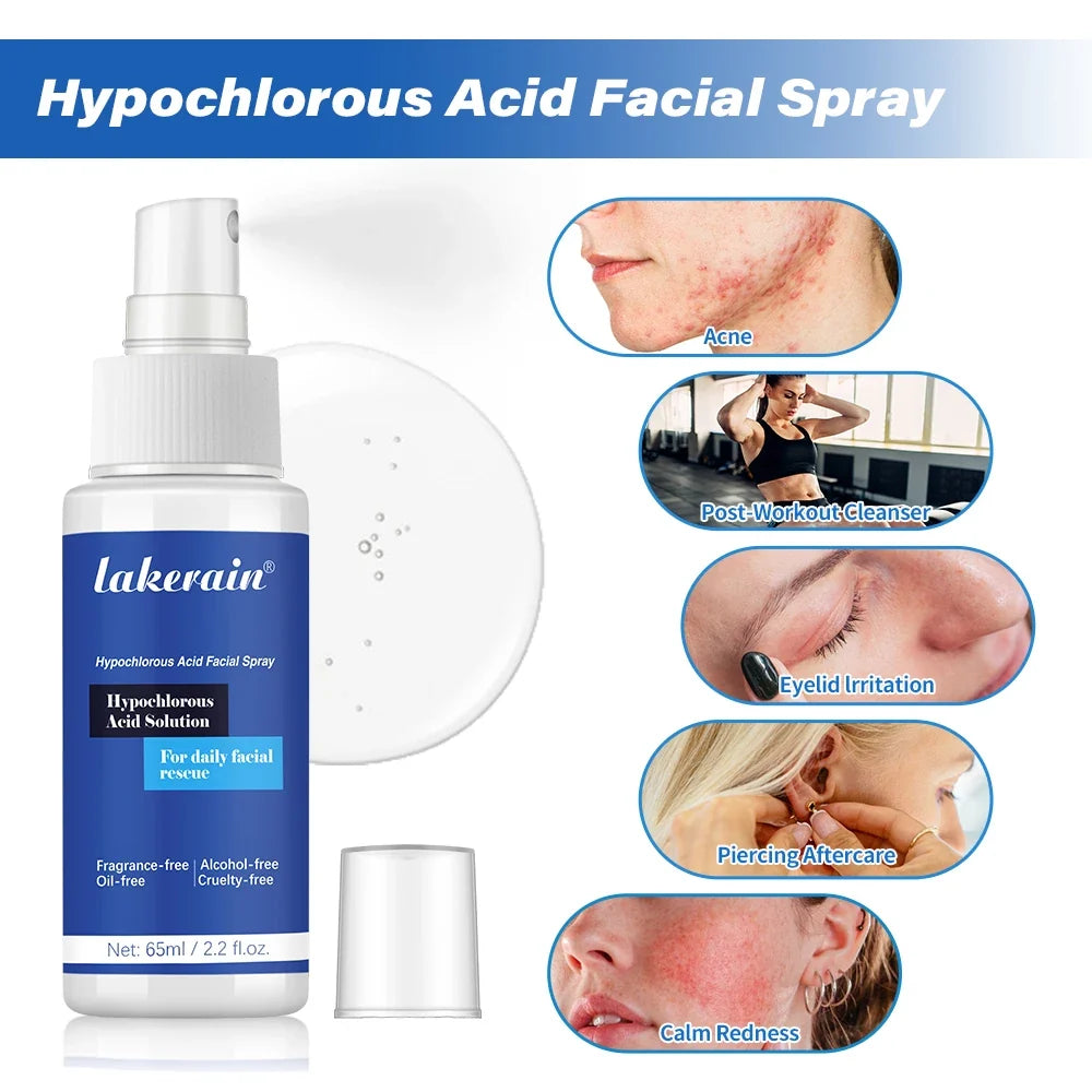 Hypochlorous Acid Facial Spray – Calm Redness & Acne | 65ml