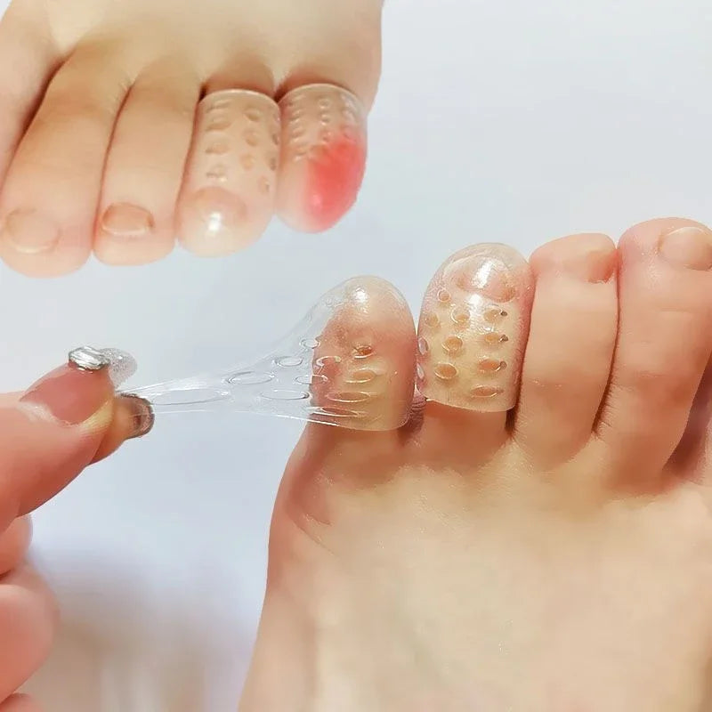Silicone Toe Protector Caps – Anti-Friction | 5 or 10 Pack