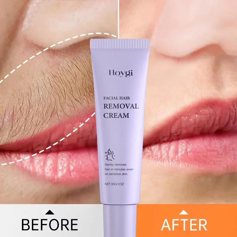 3-Minute Hair Removal Cream – Face, Lip, Arms & Legs