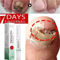 Nail Repair Serum – Foot & Toe Nail Restoration Oil