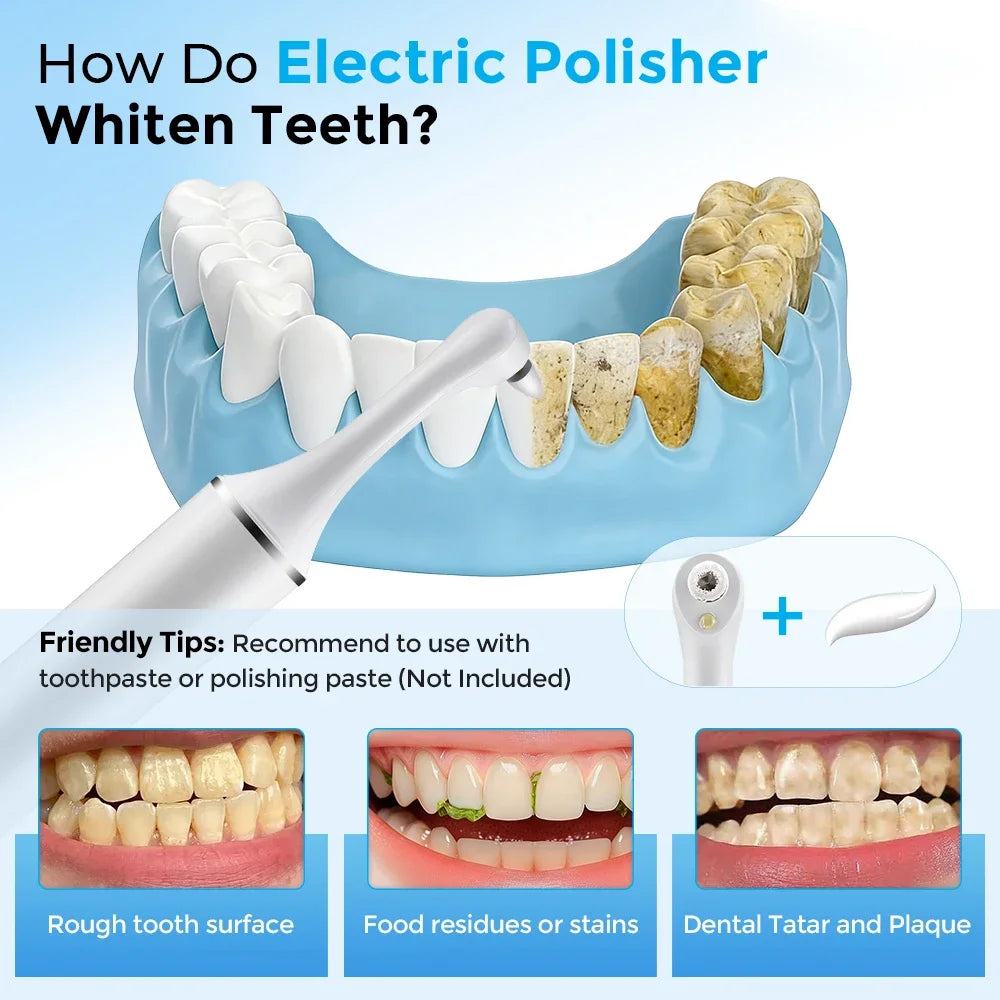 Electric Tooth Polisher Whitening Kit – 5 Modes & 6 Brush Heads