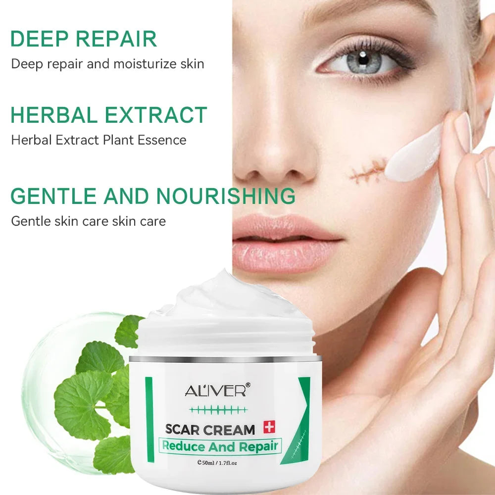 ALVER Acne Scar & Stretch Mark Remover Cream 50ml | Skin Repair