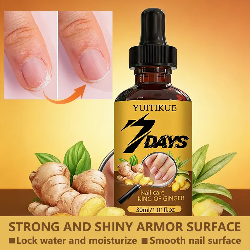 Ginger Nail Care Oil – Nourish, Strengthen & Shine 30ml