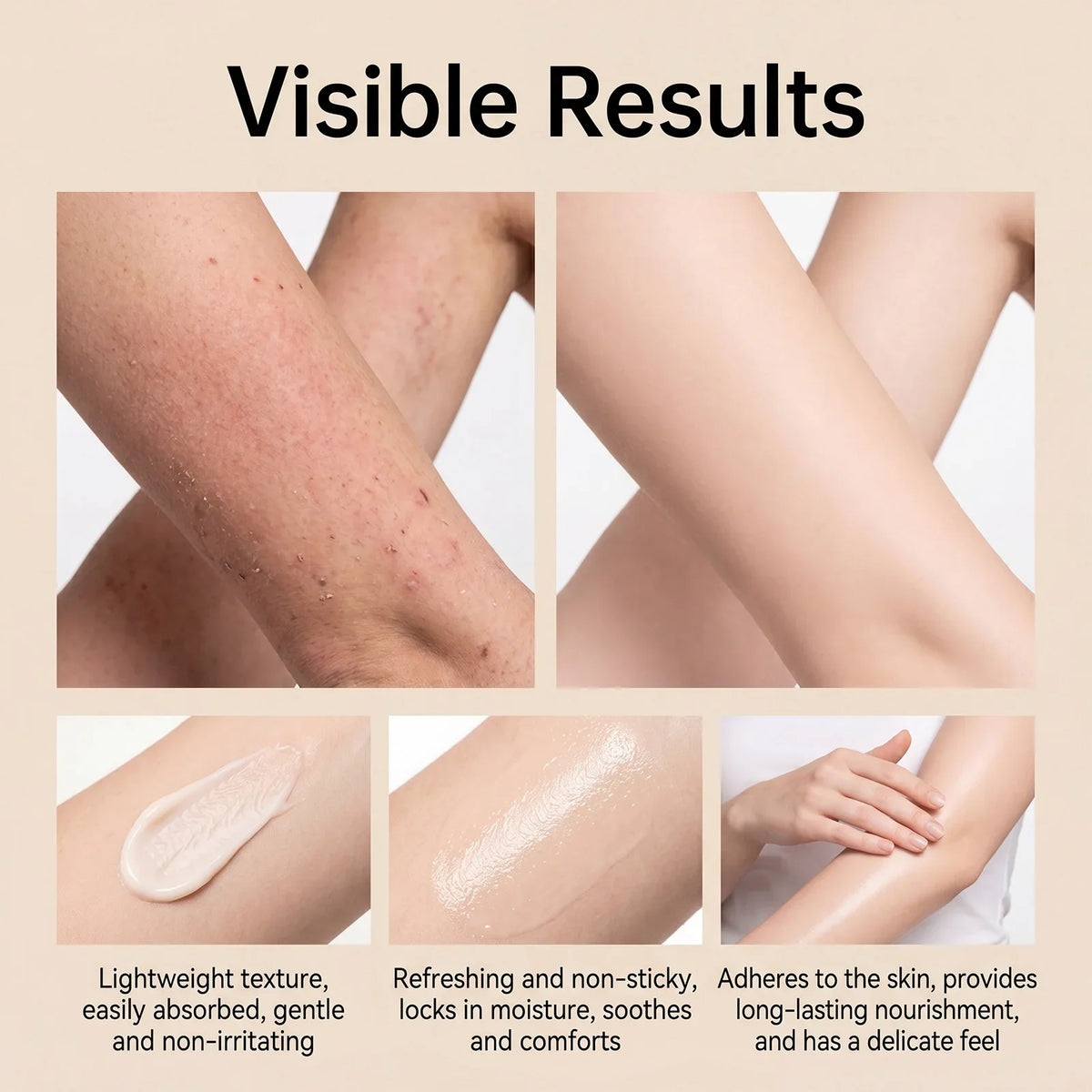 Soothing Scar Cream – Hydrating, Brightening & Skin Balancing