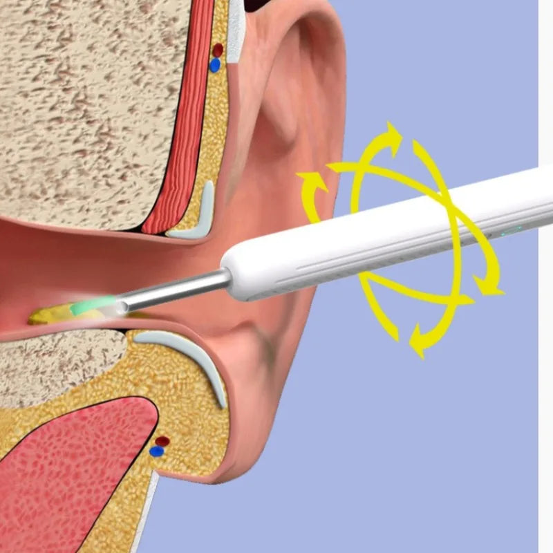 Ear Wax Removal Kit HD 1080P Camera – iOS & Android