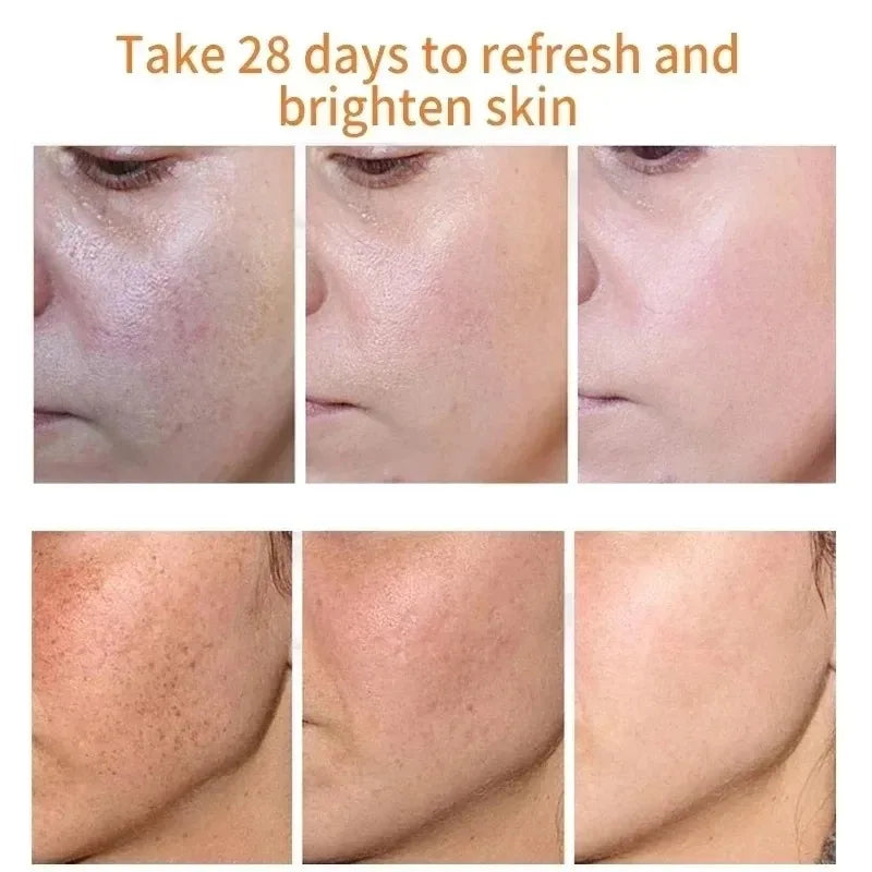 REAROYA Niacinamide Dark Spot Brightening Face Cream 20g
