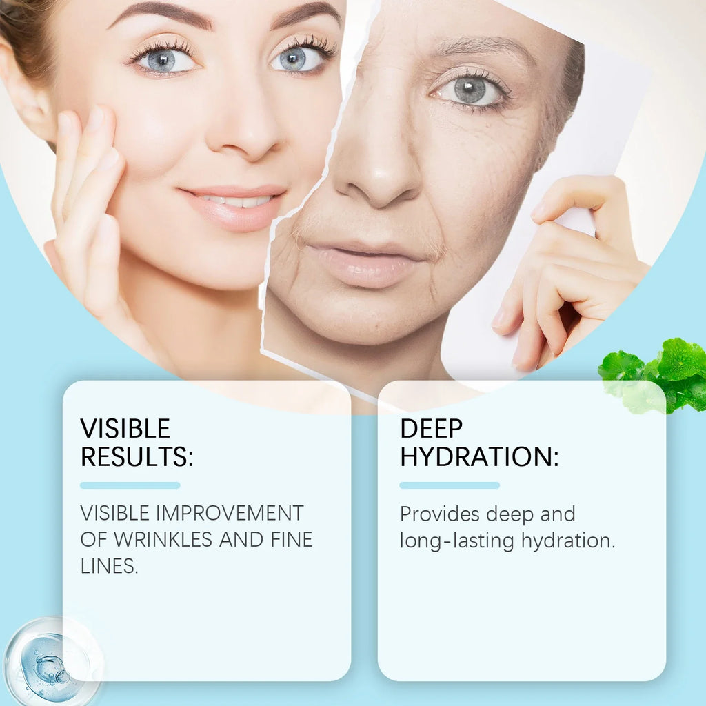 Hoygi Centella Moisturizing Cream – Hyaluronic Acid Skin Repair