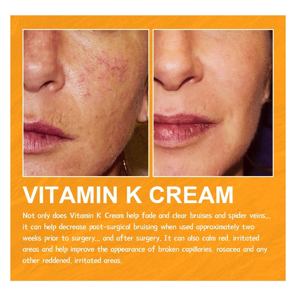 Vitamin K Leg Massage & Skin Care Cream 60g – Daily Moisturiser