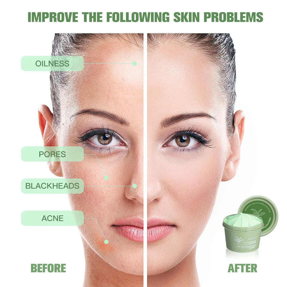 Green Tea Mud Clay Face Mask – Deep Cleansing & Pore Care 100g