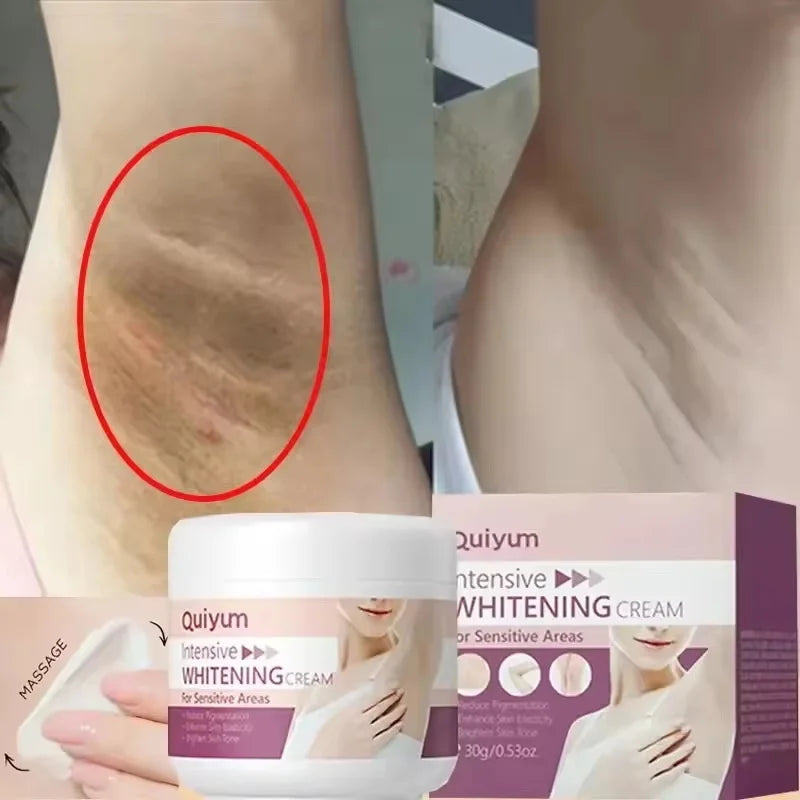 Eelhoe Brightening Cream – Underarm & Intimate Area Care