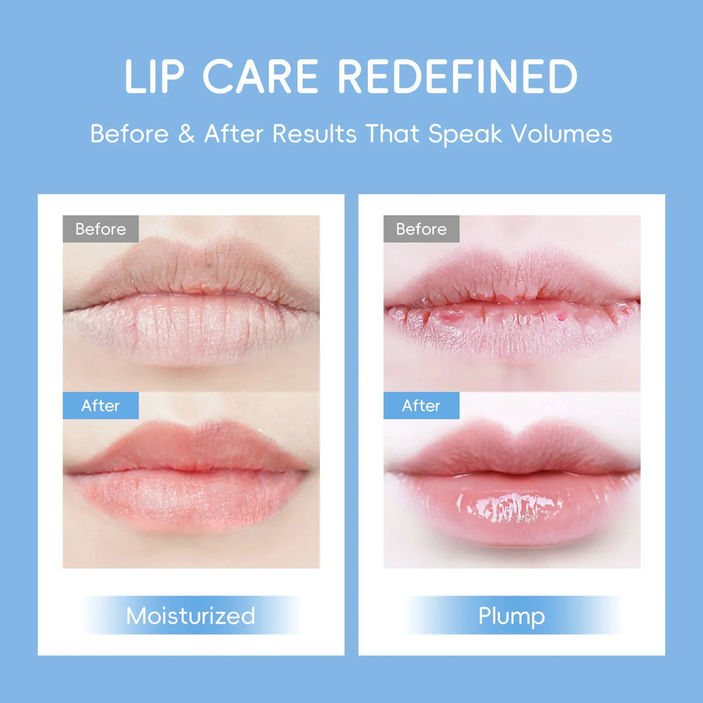 LAIKOU Milk Collagen Lip Mask – Hydrating & Line Repair