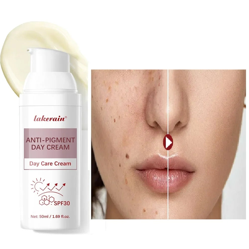 Anti-Pigment Day Cream SPF 30 | Brightening & Even Skin Tone