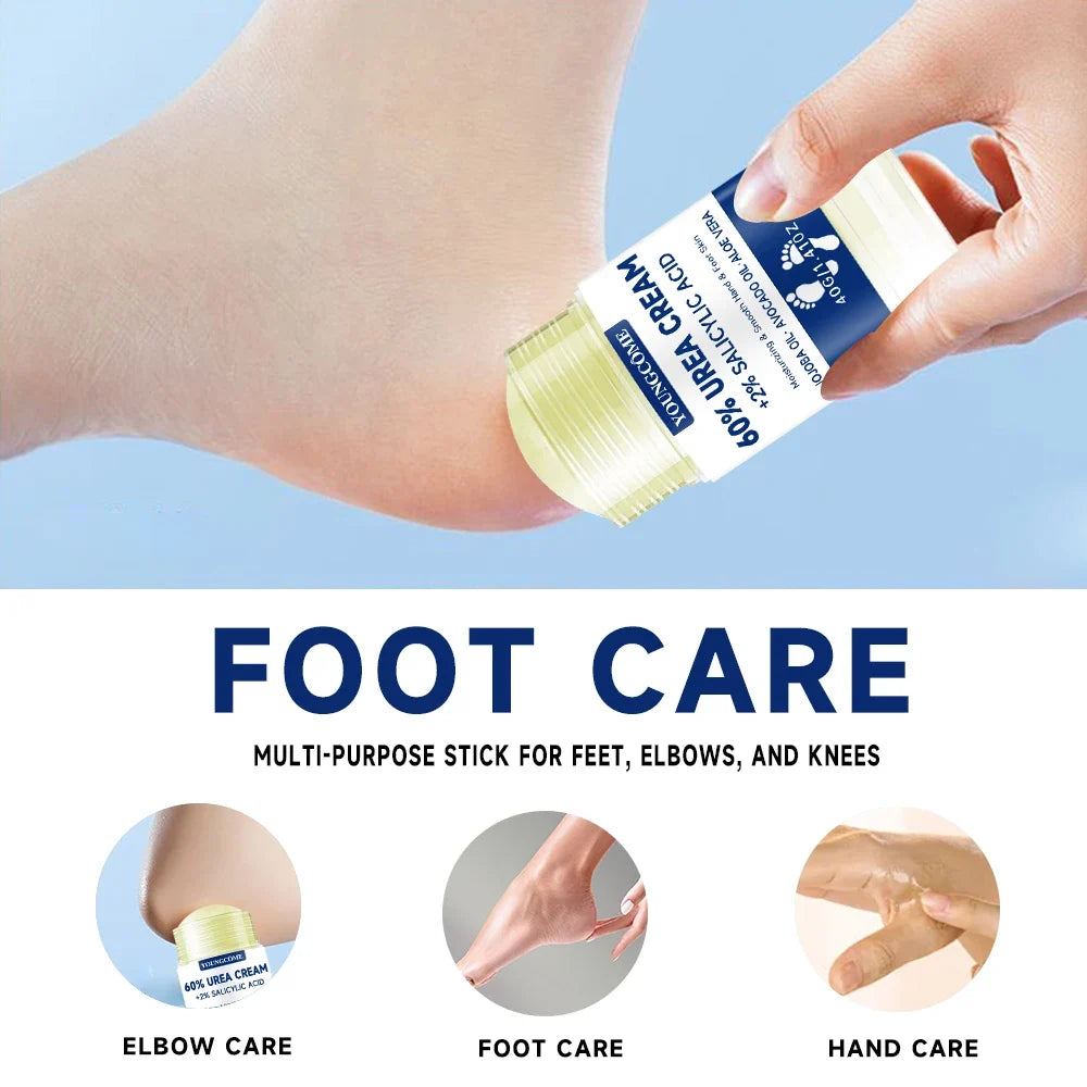 YOUNGCOME 42% Urea + 2% Salicylic Acid Foot & Hand Cream
