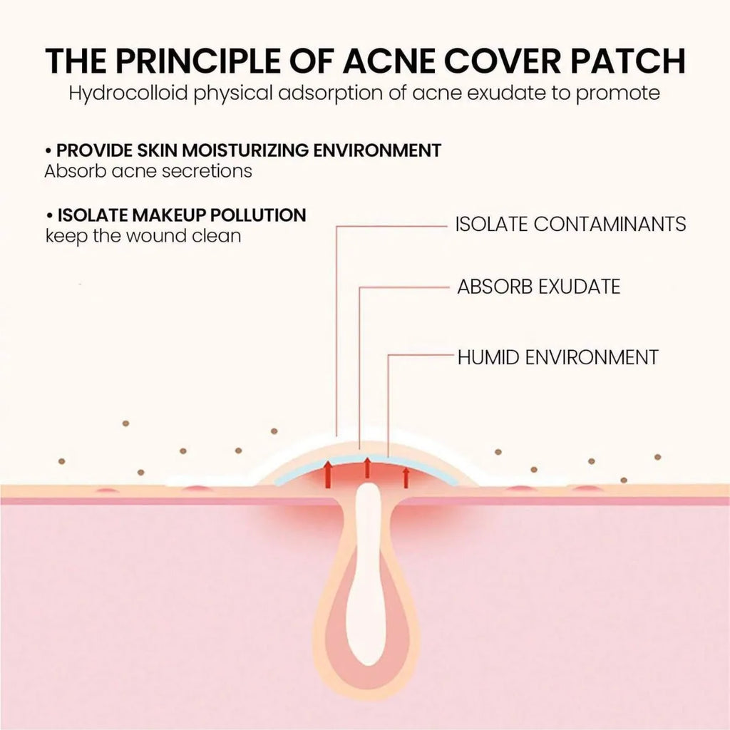 200pc Star-Shaped Colorful Pimple Patches – Invisible PE Cover