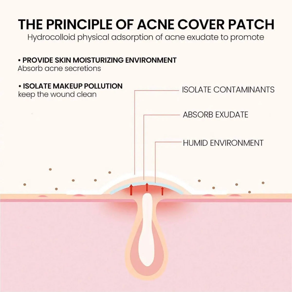 200pc Star-Shaped Colorful Pimple Patches – Invisible PE Cover