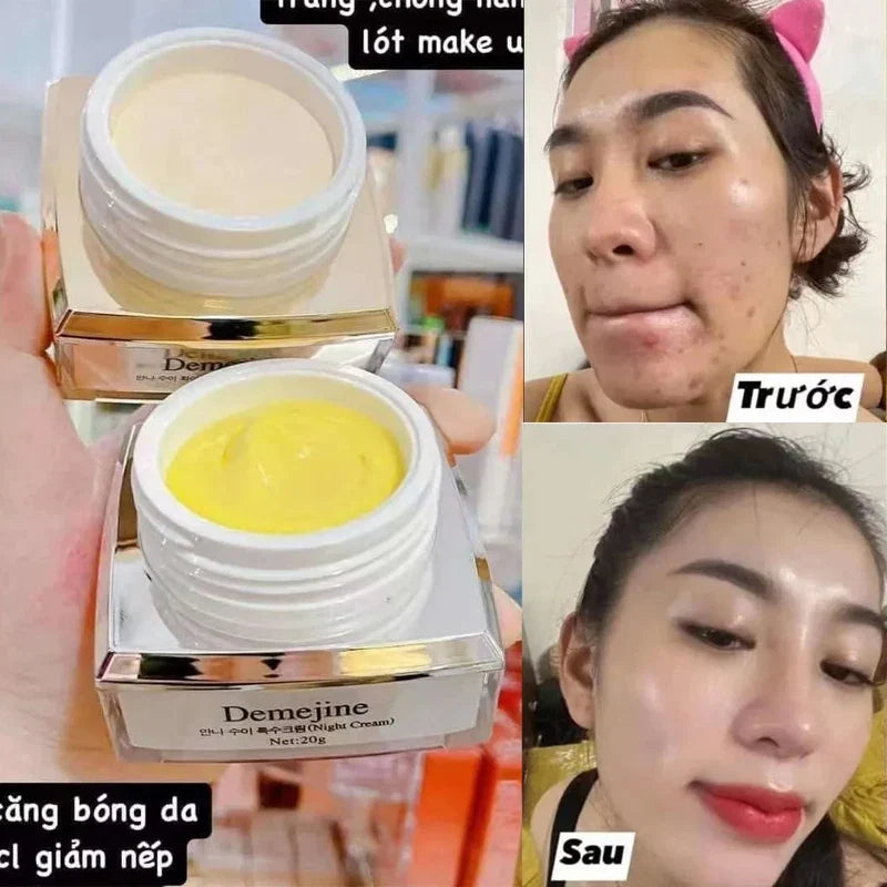 Day & Night Whitening Cream – Dark Spots, Pores & Anti-Aging