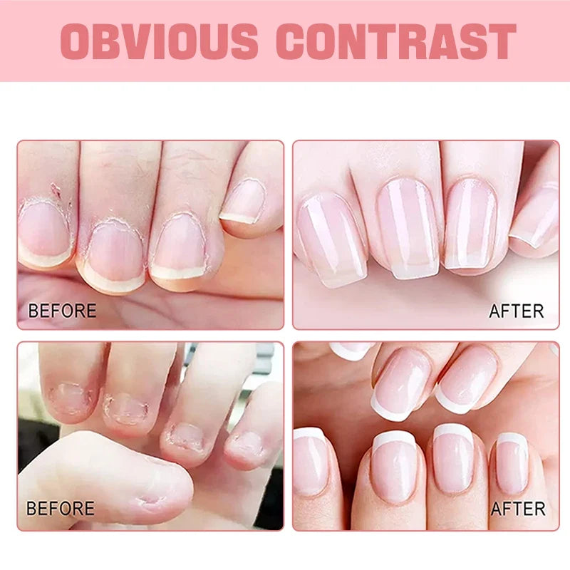 Nail Cuticle Oil – Honey, Rose & Vitamin E Nail Treatment