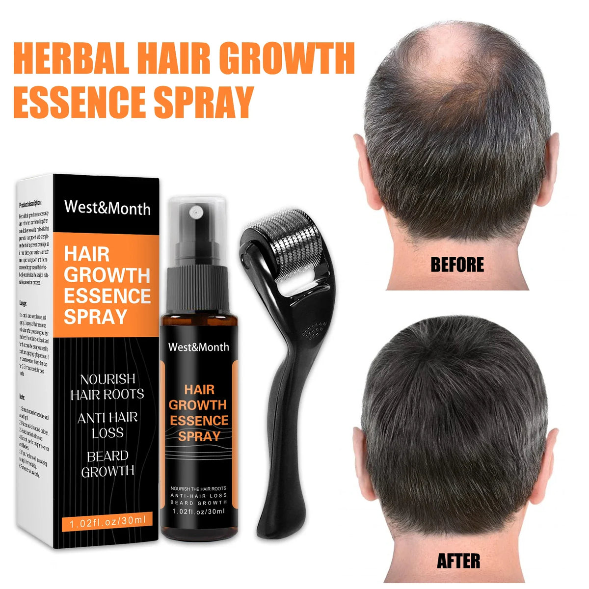 Hair Thickening Scalp Spray – Polygonum & Ginger Nourishment