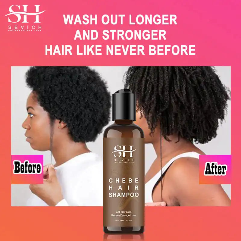 SEVICH Chebe Hair Growth Shampoo & Conditioner Set | Anti Hair Loss