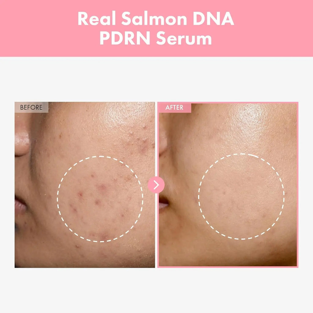 Pdrn Pink Peptide Serum Targets Dark Spots Strengthens Skin's Barrier