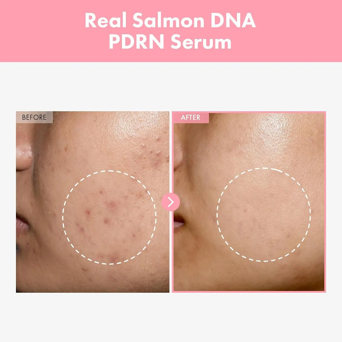 Pdrn Pink Peptide Serum Targets Dark Spots Strengthens Skin's Barrier