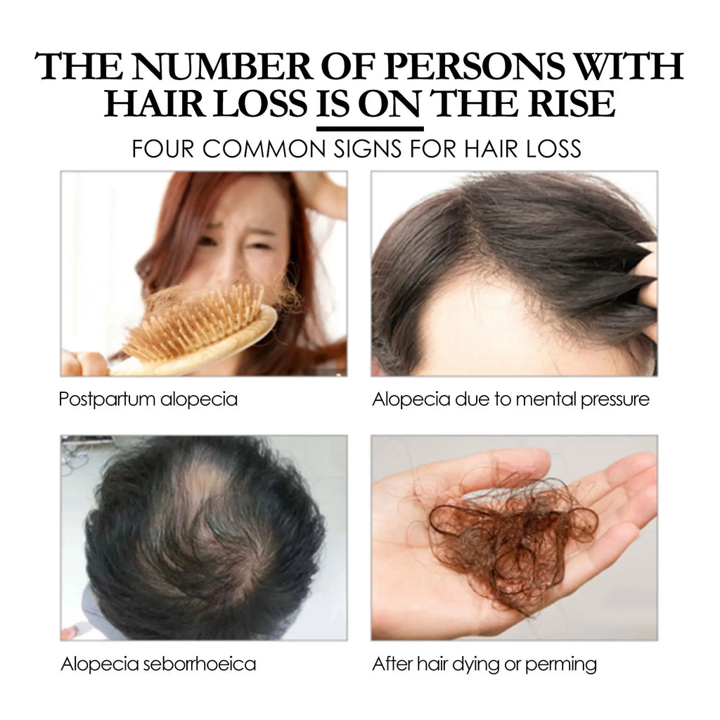 Eelhoe Batana Hair Conditioner & Growth Spray Kit | Dry Hair Repair