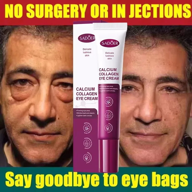 SADOER Collagen Eye Cream – Brighten & Firm Under Eyes